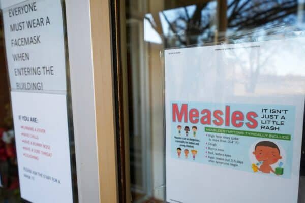 US measles cases. UU. They reach the highest number in 33 years: CDC US measles cases. UU. They reach the highest number in 33 years: CDC